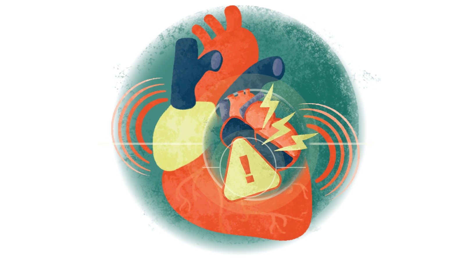 Illustration of an electrical jolt and exclamation point over a heart in failure