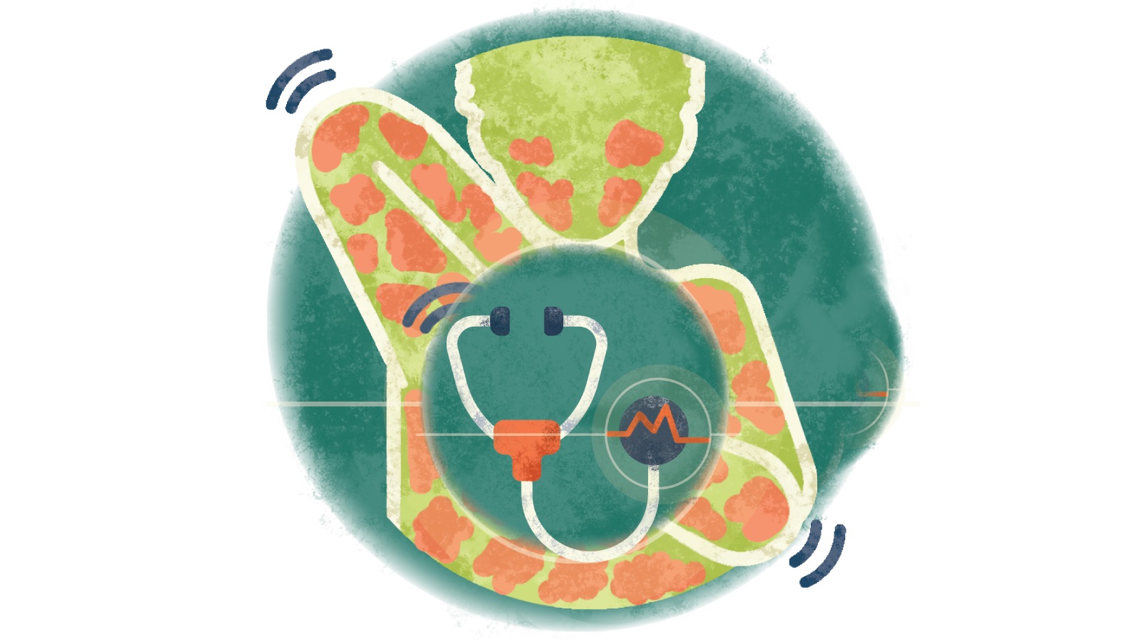 Illustration of a stethoscope with an electrocardiogram in a circle over a person itching the hives all over their body