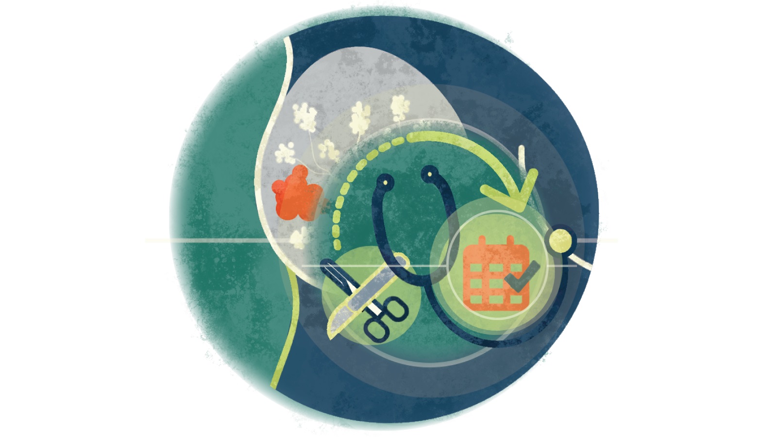 Illustration of a scissors and scalpel, stethoscope, and calendar with an appointment in a circle over a breast with cancer