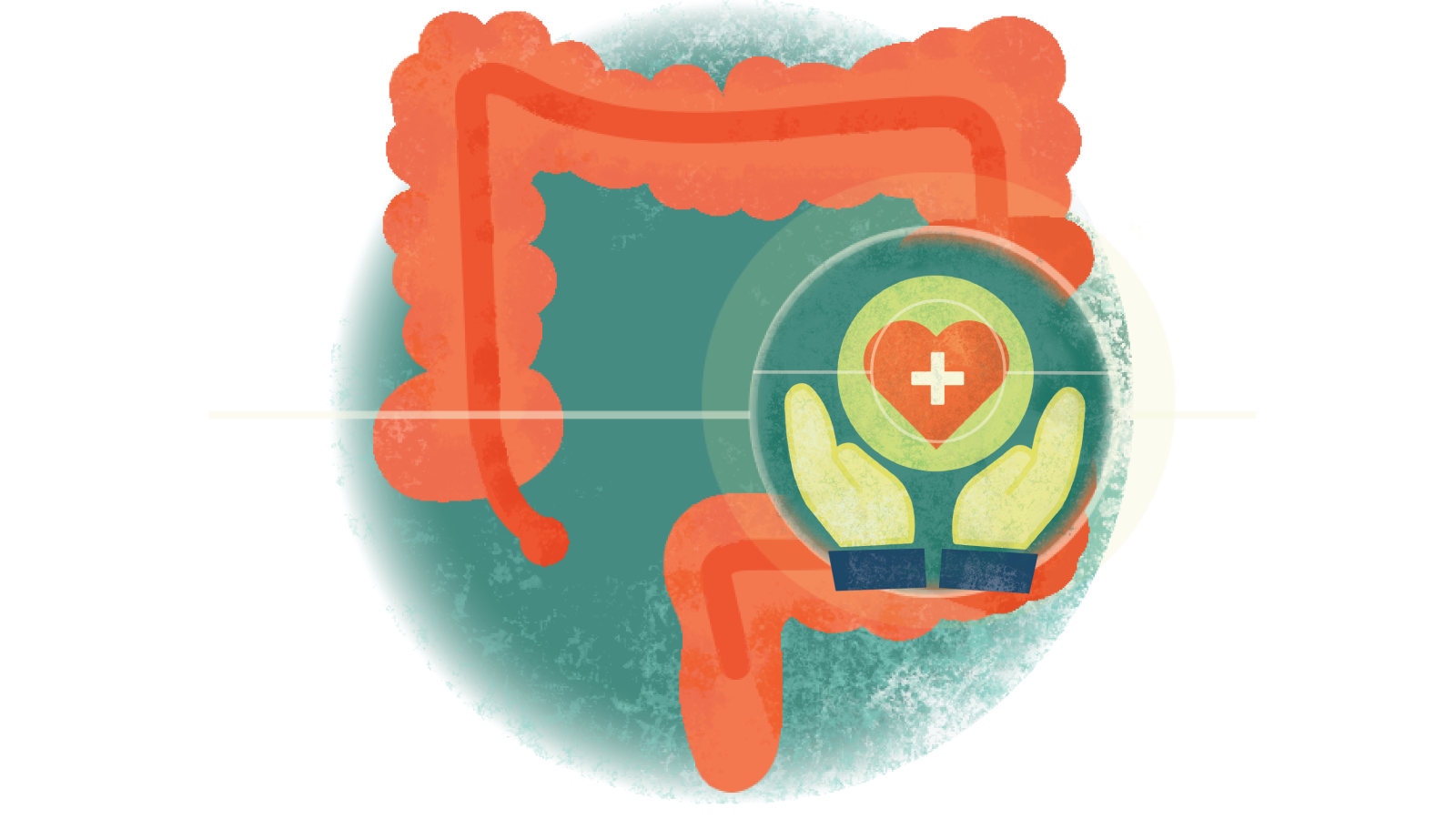 Illustration of hands holding a heart with a + sign in a circle over a colon with ulcerative colitis