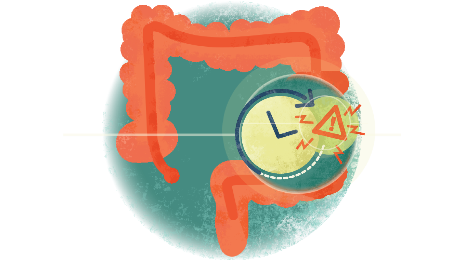 Illustration of a letter L with an arrow with an exclamation point inside a triangle over a colon with ulcerative colitis