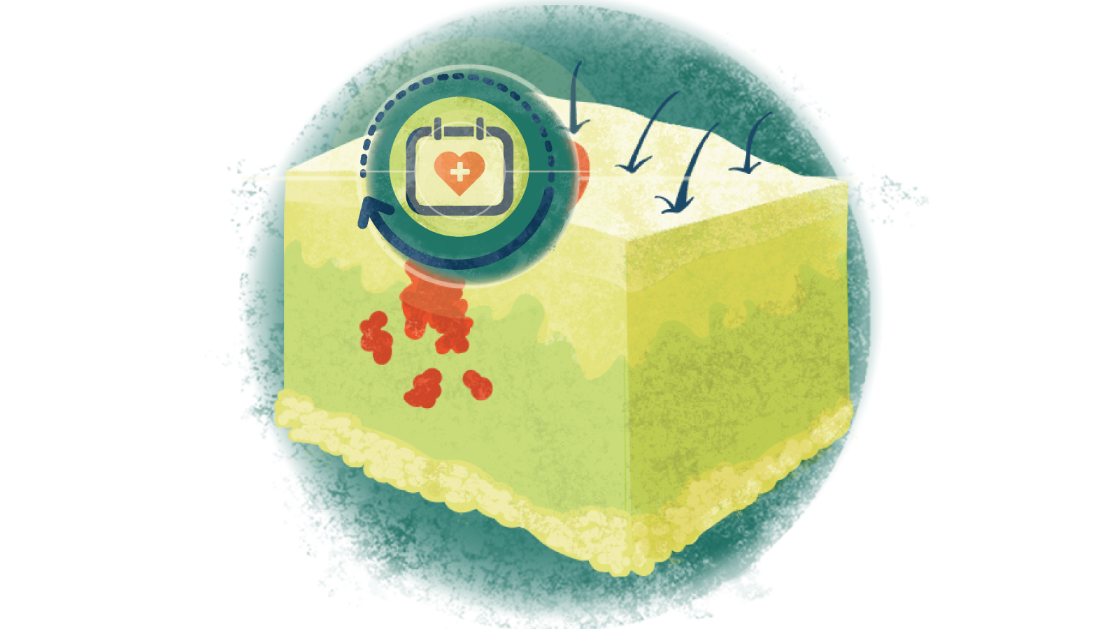 Illustration of a red medical plus icon in a circle over a heart calendar with arrows going around over melanoma of the skin