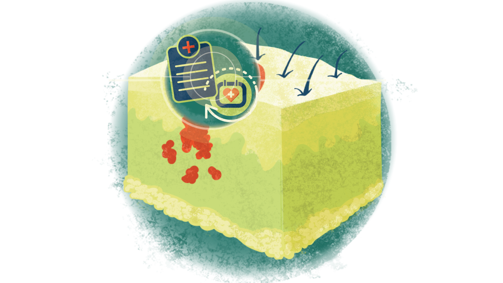 Illustration of a patient's medical clipboard and a red medical plus icon in a circle over a heart calendar with arrows going
