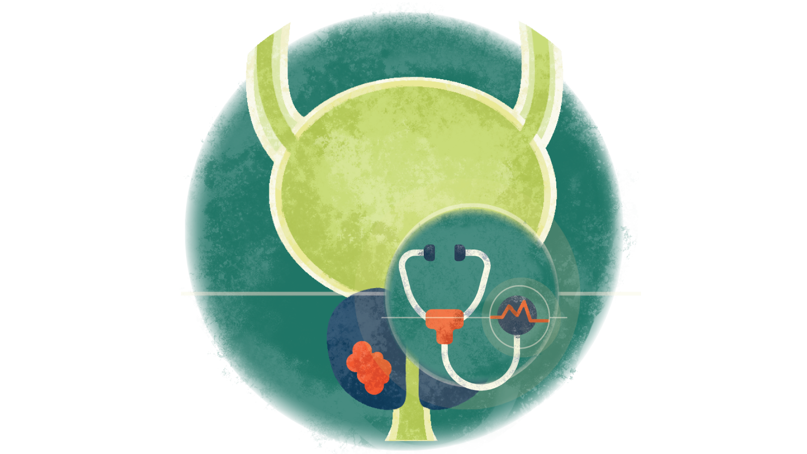 Illustration of a stethoscope with an electrocardiogram in a circle over osteoporosis