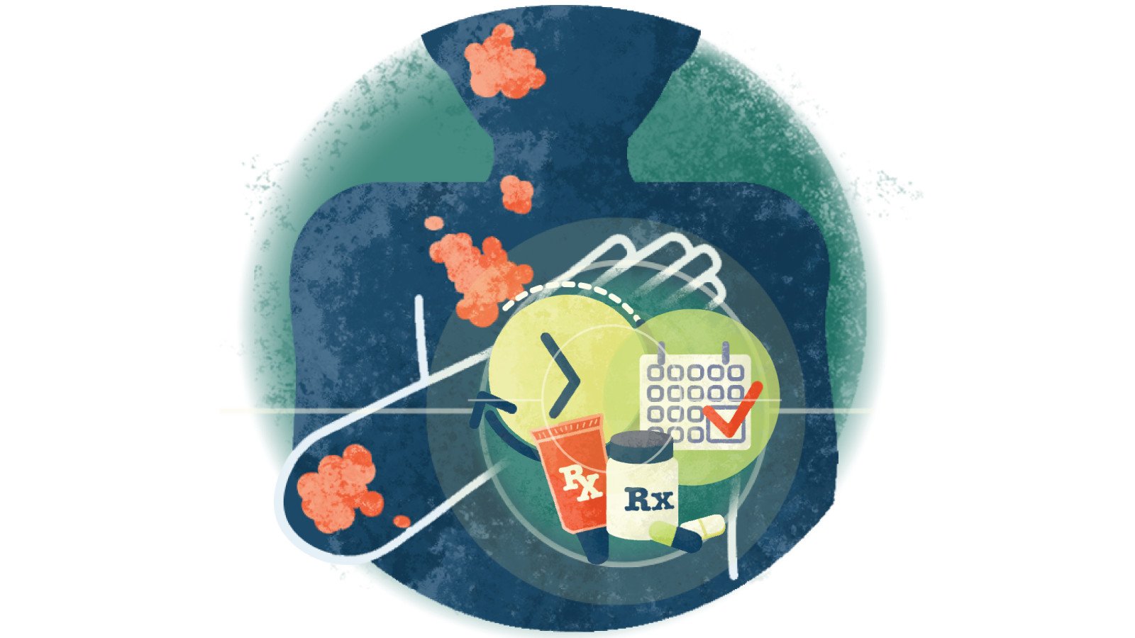 Illustration of prescription bottle and a calendar with a check mark with atopic dermatitis falling down onto the arm