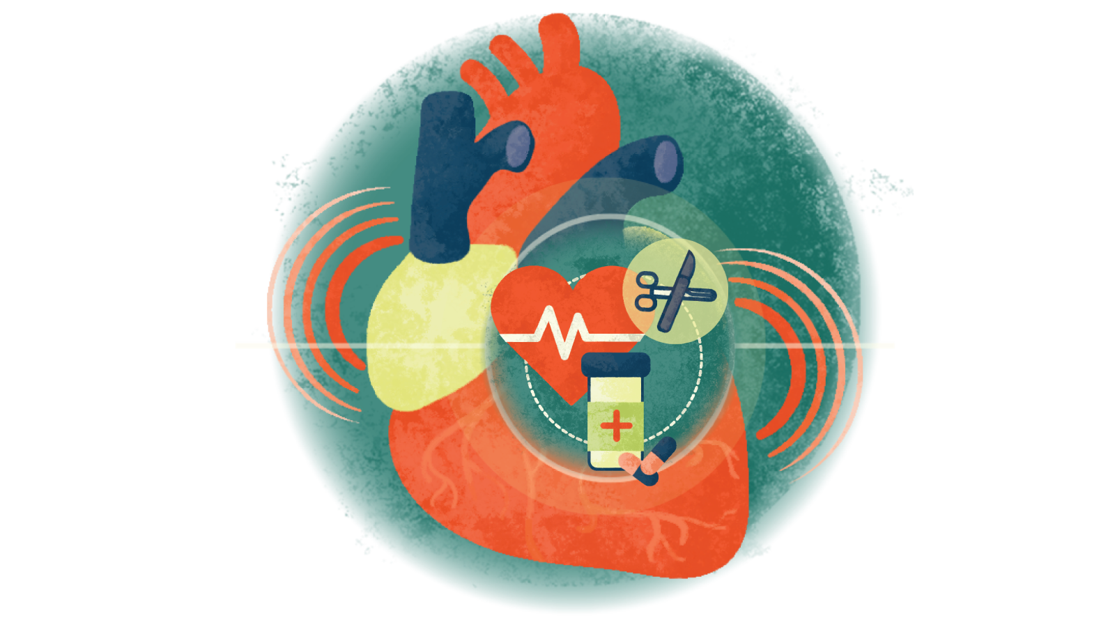 Illustration of a prescription bottle with pills, scalpel and scissor over a heart in failure