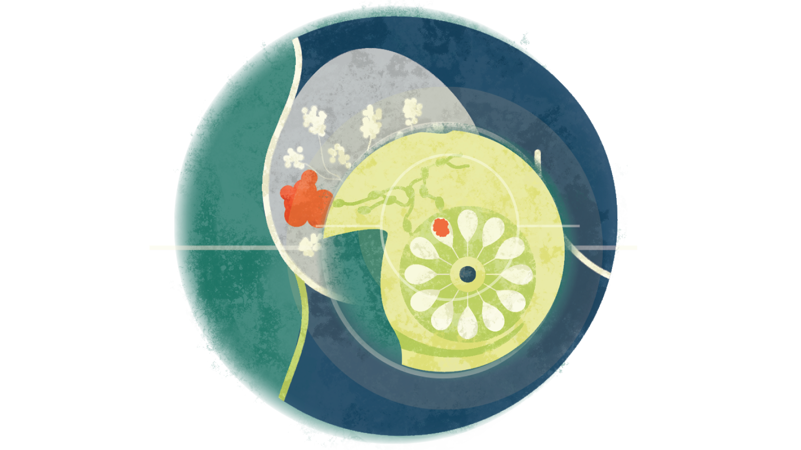 Illustration of early stages of breast cancer over a breast with cancer