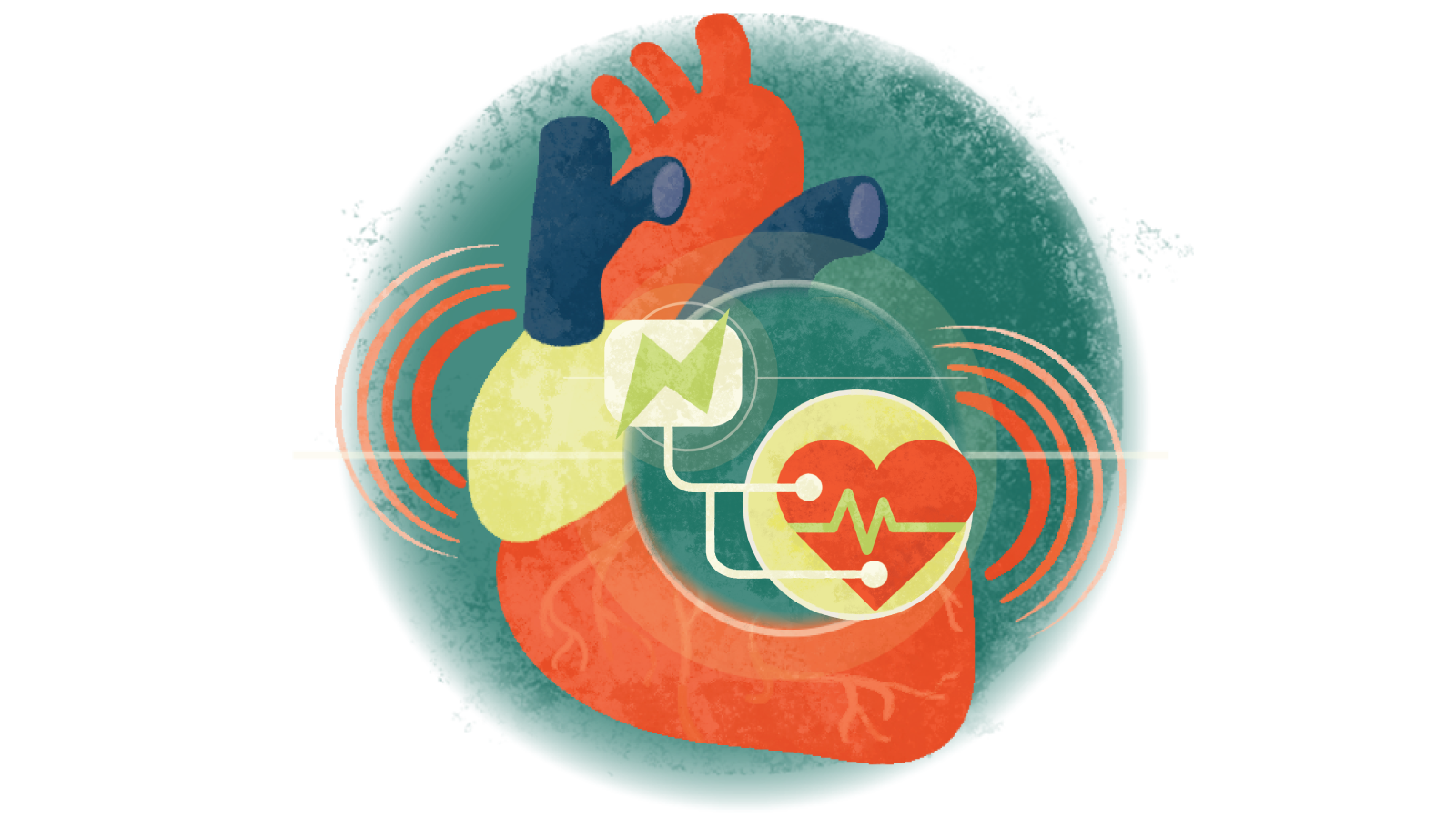 Illustration of an electrical jolt with an electrocardiogram over a heart in a circle over a heart in failure