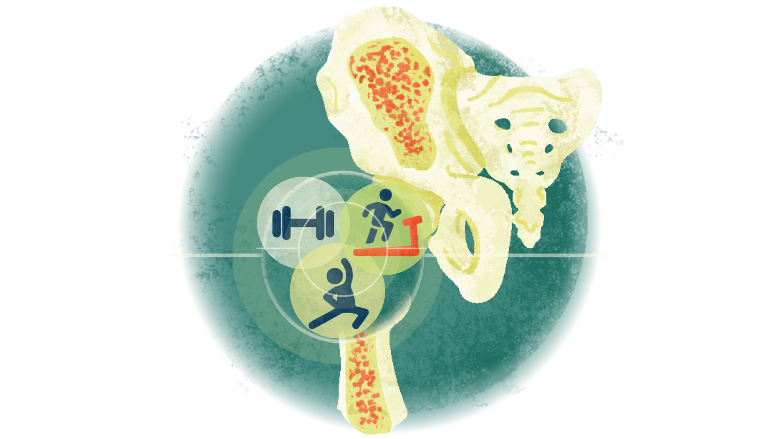 Illustration of three forms of exercise over a bone with osteoporosis