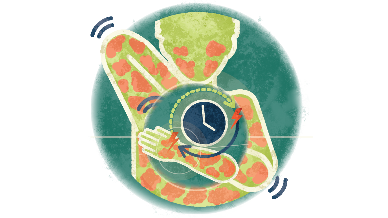 Illustration of arrows going around a clock with electrocardiogram bolts over a person itching the hives all over their body