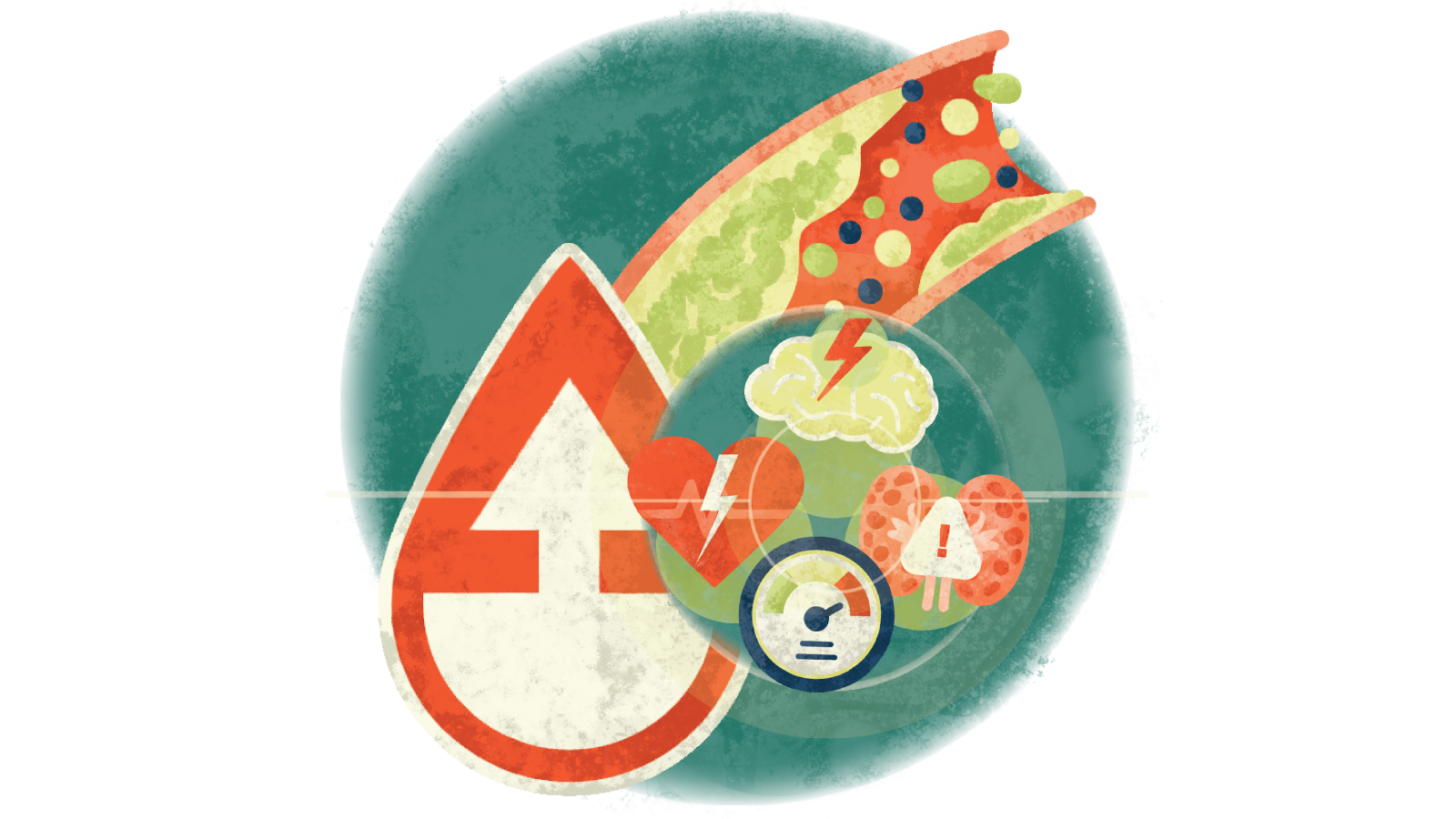 Illustration of the consequences of what atherosclerosis can do over a blood droplet with an upward arrow over cholesterol