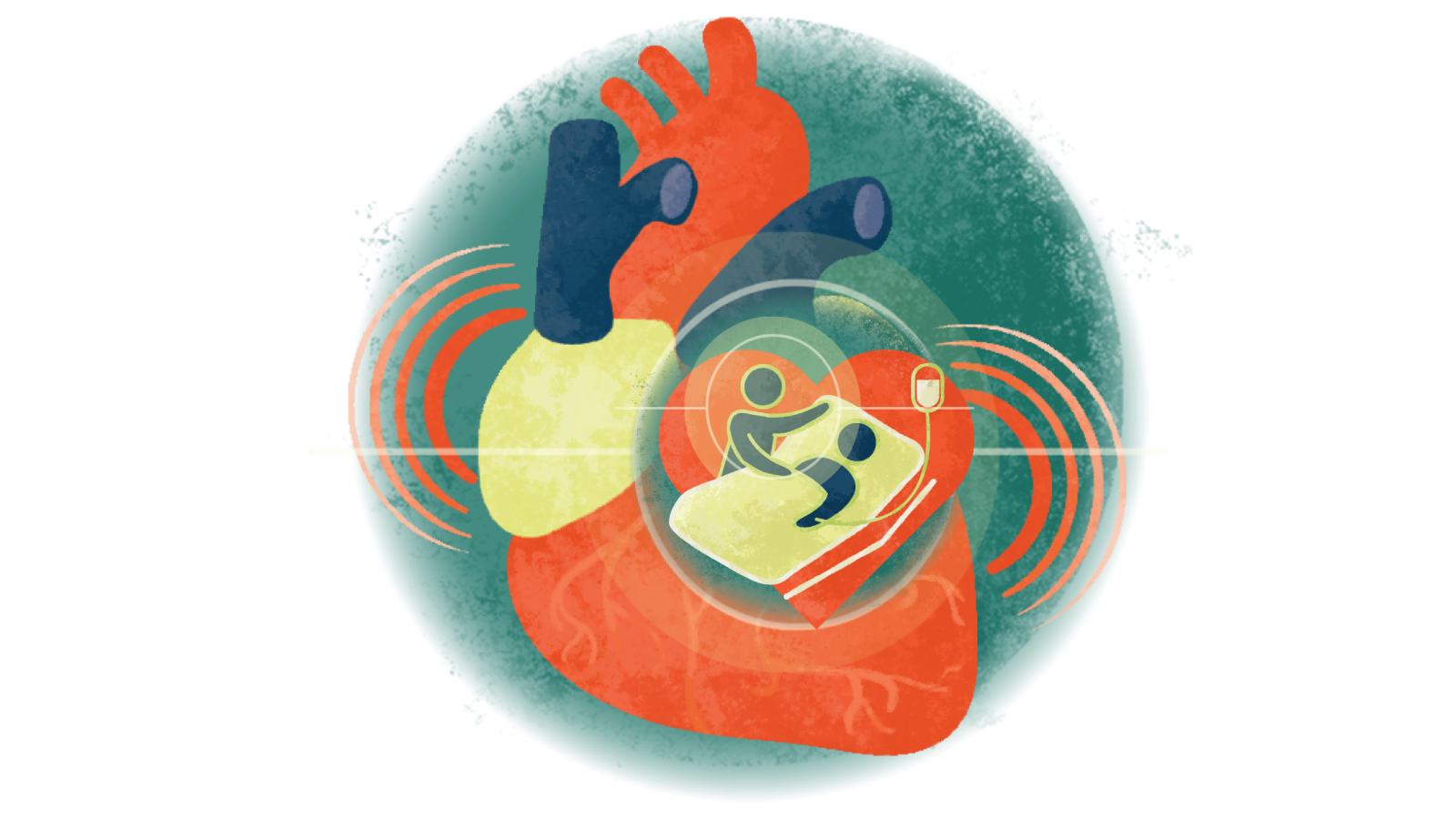 Illustration of a caregiver taking care of a patient with an IV in bed in a circle over a heart in failure