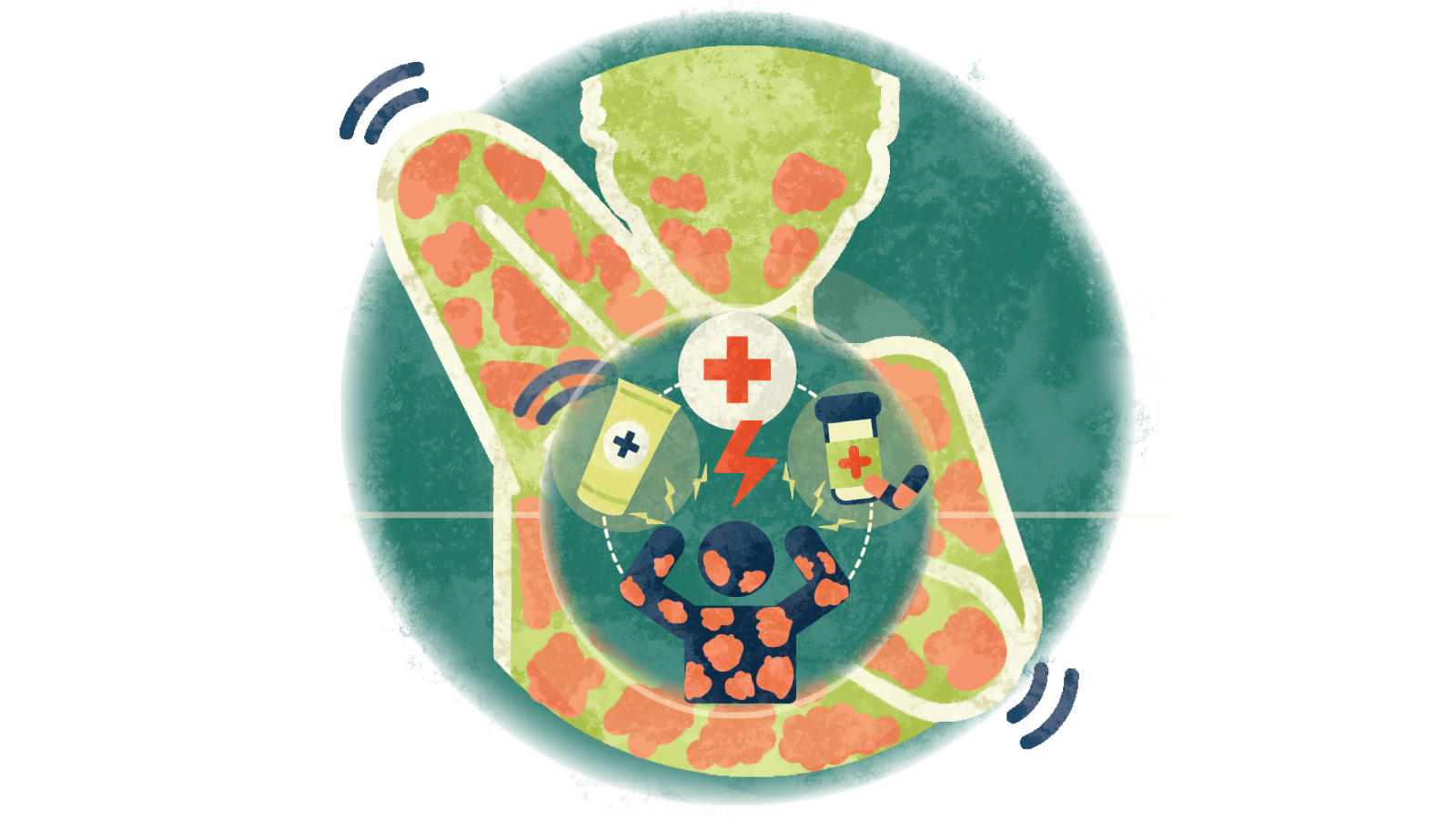 Illustration of different treatment options for hives over a person itching the hives all over their body