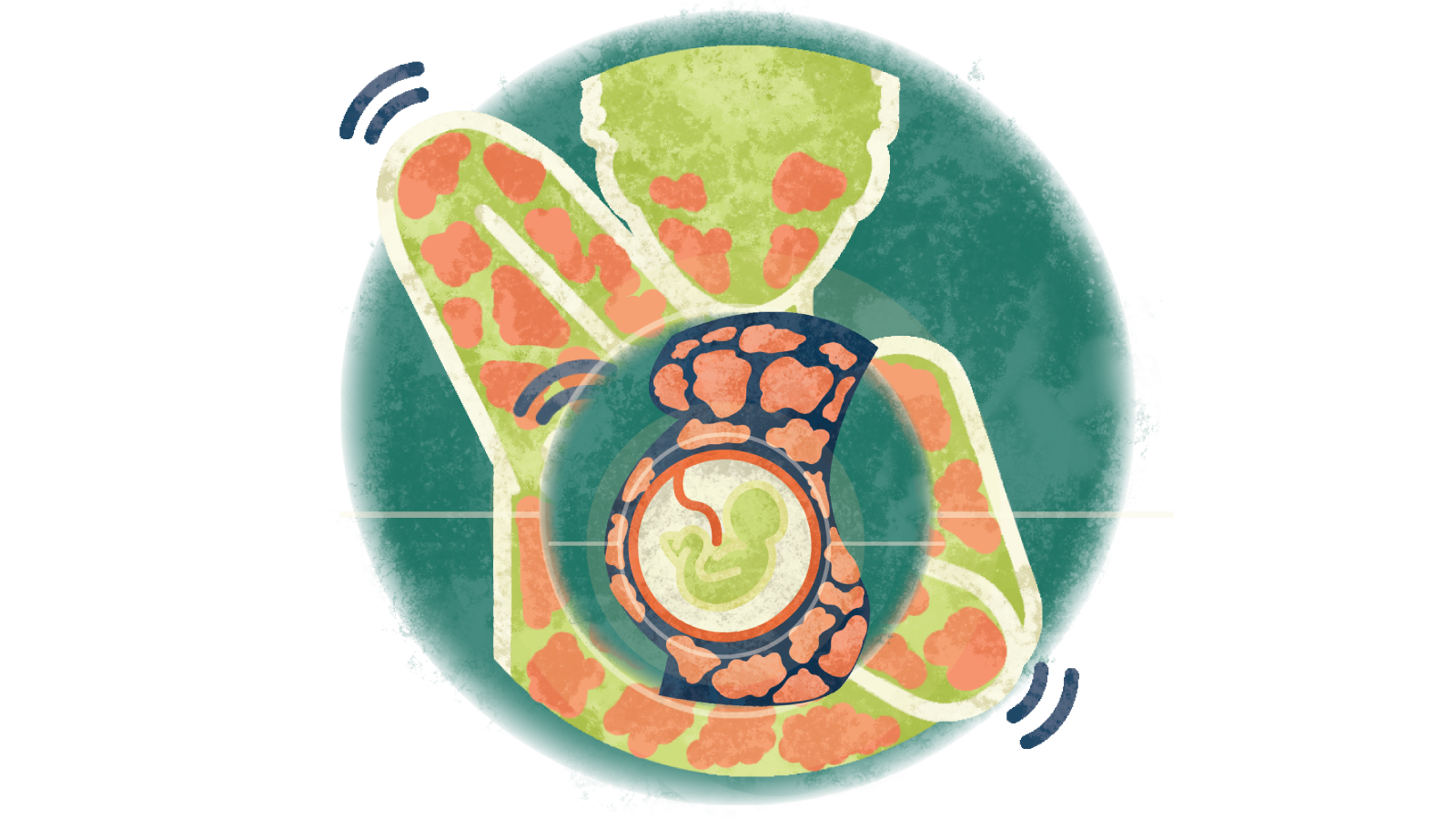 Illustration of a baby in the stomach of a pregnant woman with hives over a person itching the hives all over their body
