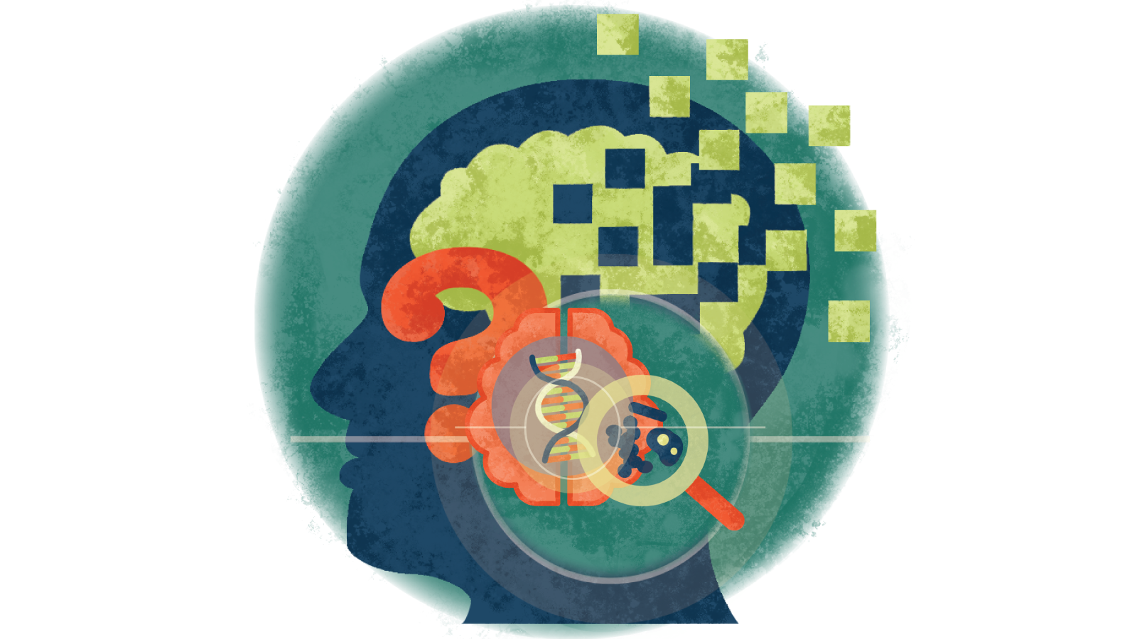 Illustration of a magnifying glass looking at disease over a strand of DNA over a ? over a person's brain with Alzheimer's