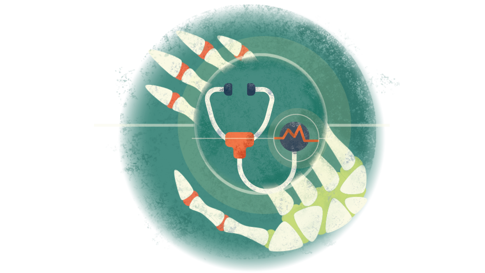 Illustration of a stethoscope with an electrocardiogram over a skeletal hand with RA