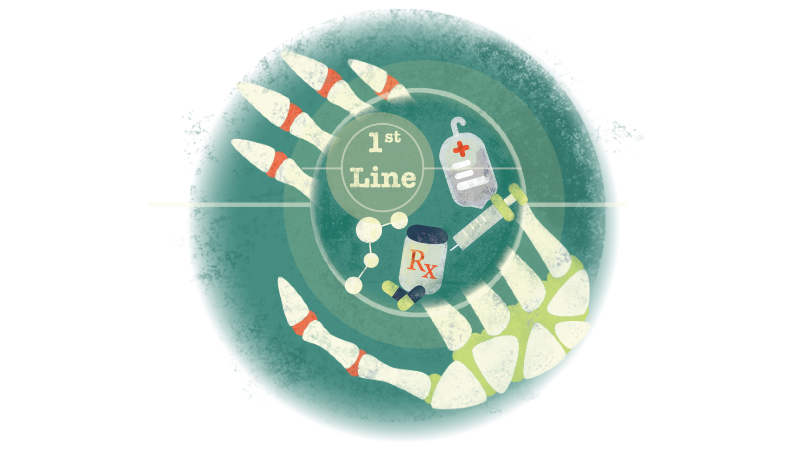 Illustration of pills, syringe, IV bag with text 1st in a circle over a skeletal hand with RA