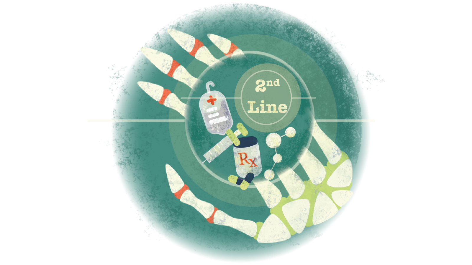 Illustration of pills, syringe, IV bag with text 2nd Line in a circle over a skeletal hand with RA