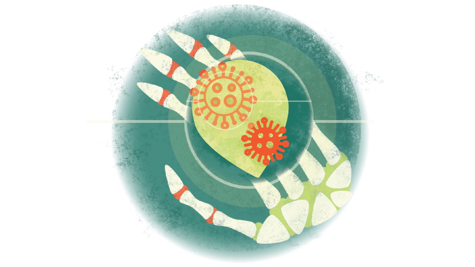 Illustration of corona viruses over a skeletal hand with RA