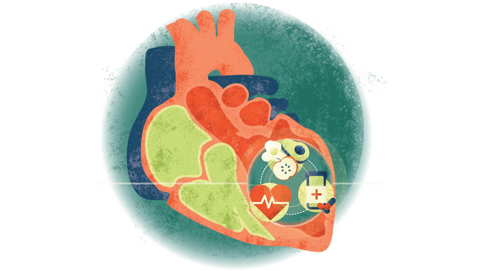 Illustration of an electrocardiogram over a heart, fruits, and medication bottle with pills over a heart with cardiomyopathy