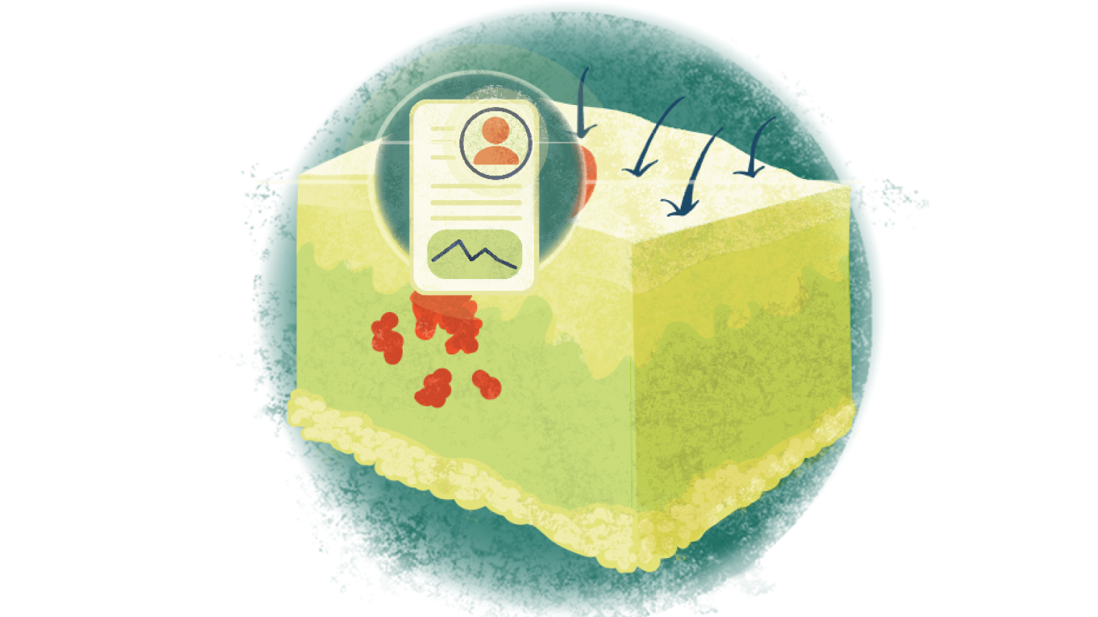 Illustration of a written case study over melanoma of the skin